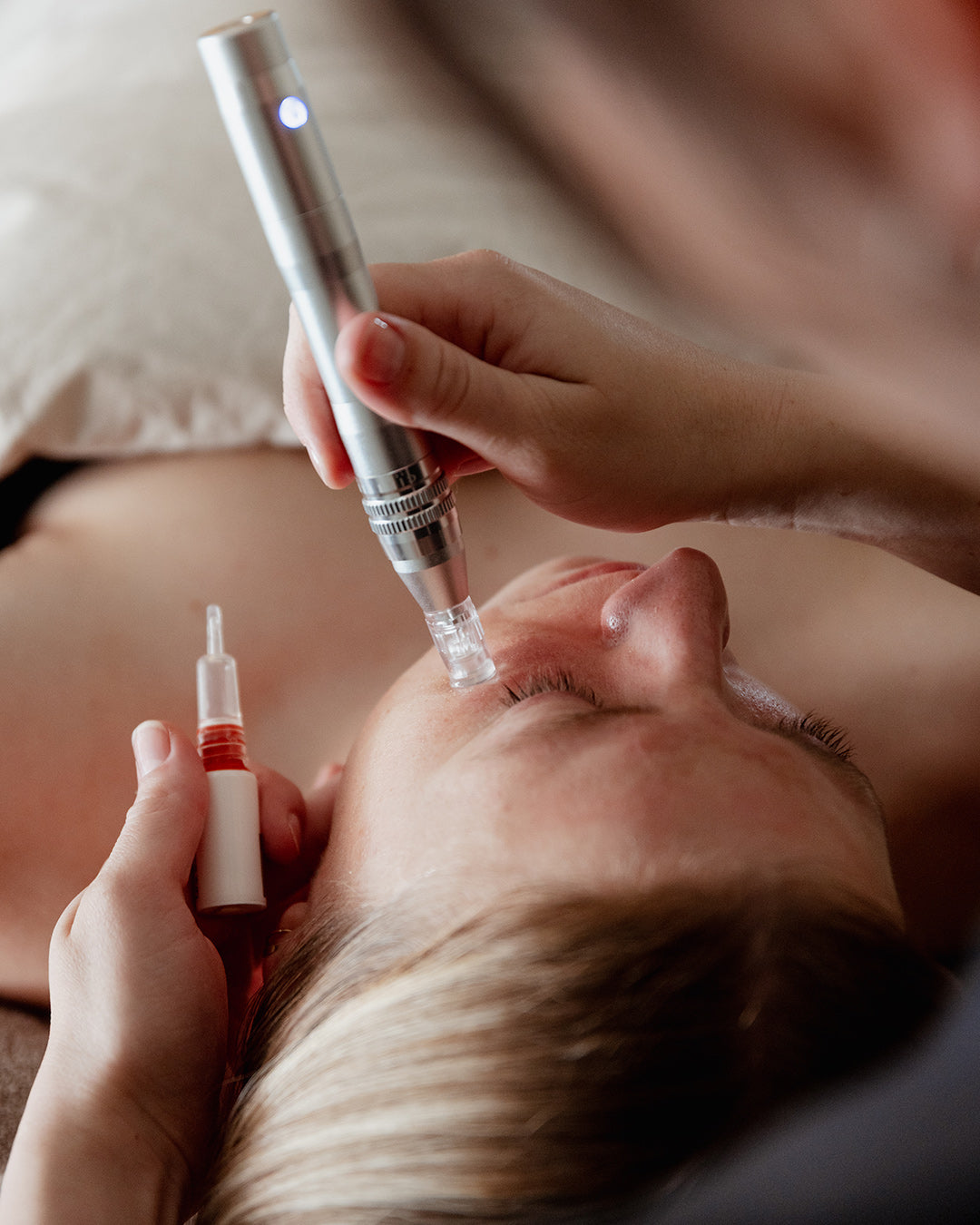 Micro Needling ansigtsbehandling hos Højholt Hudpleje